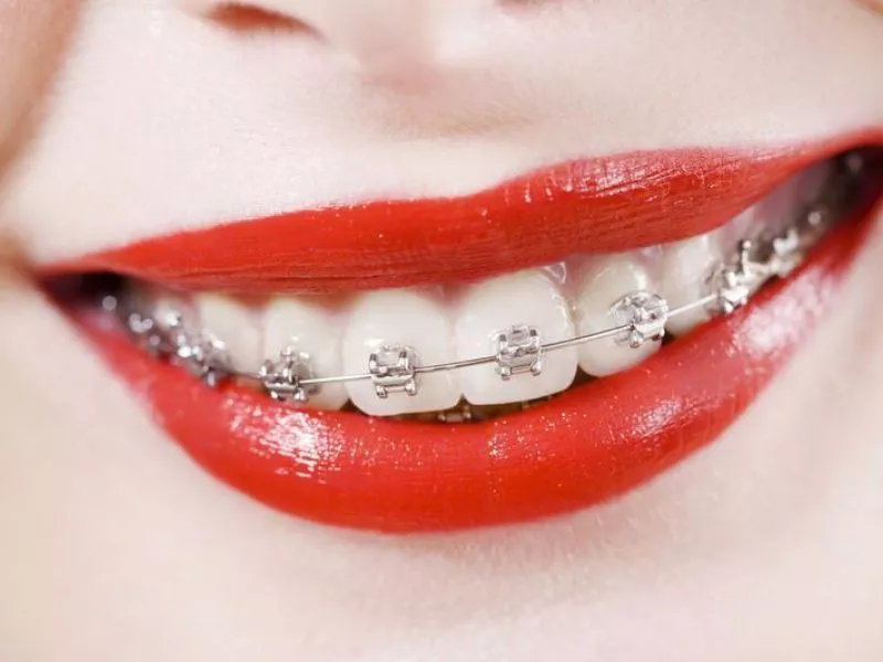 Почему Atribeaute Dental Boutique или секреты мастерства